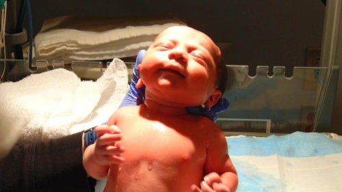Il diabete gestazionale in genere non pregiudica la salute del bambino