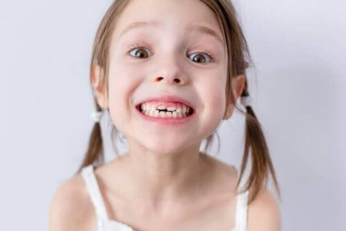 denti da latte