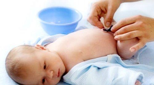 disinfettare cordone ombelicale neonato