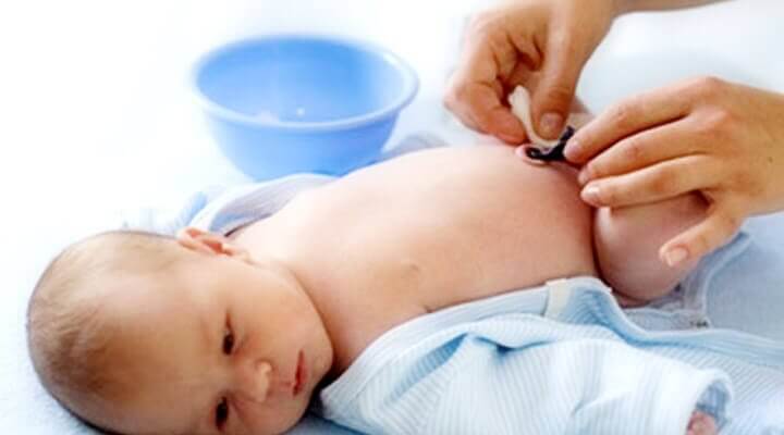 Prendersi cura del cordone ombelicale del neonato