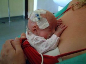 Allattare un neonato prematuro: come e perché farlo