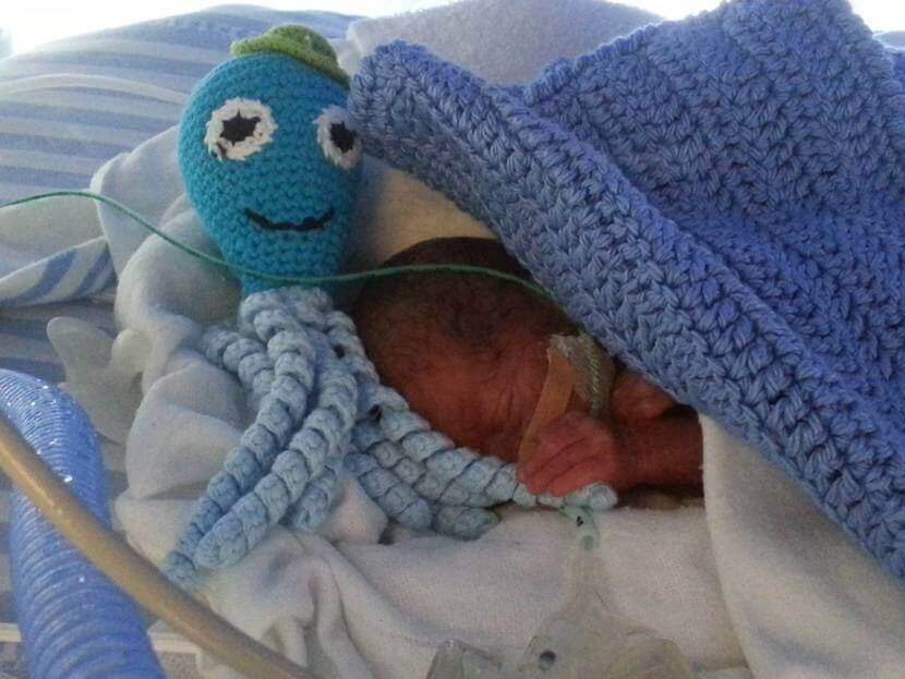Conseguenze che può avere un neonato prematuro