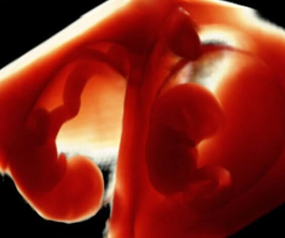 riconoscere una superfetazione