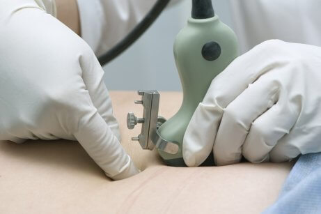 Medici effettua amniocentesi