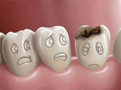 Che cosa sono le carie dentali e come è possibile prevenirle?