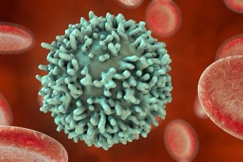 la leucemia a grandi cellule B è la forma di leucemia infantile più diffusa
