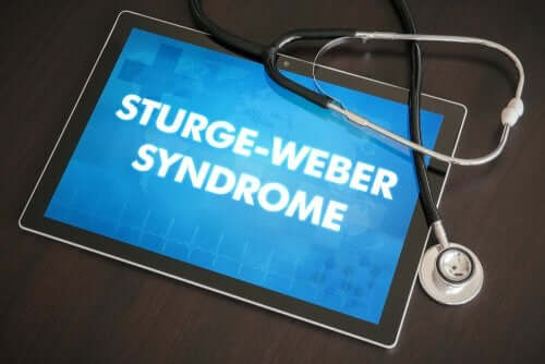 La sindrome di Sturge-Weber nei bambini