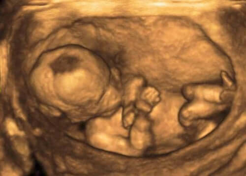 Ecografia di un bambino dentro la pancia della mamma.