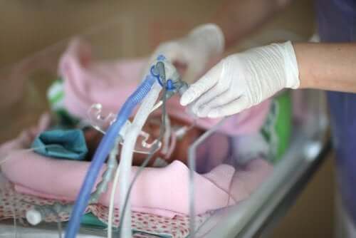 La sindrome da distress respiratorio nei neonati