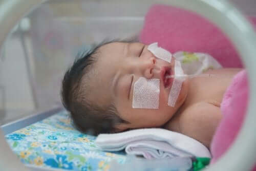 neonato intubato per sindrome da distress respiratorio