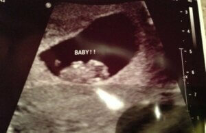 Il metodo Ramzi per scoprire il sesso del bebè