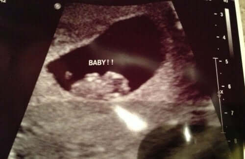 Il metodo Ramzi per scoprire il sesso del bebè