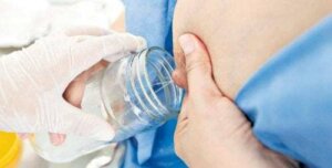 Tutto sul latte materno proveniente dalla donazione