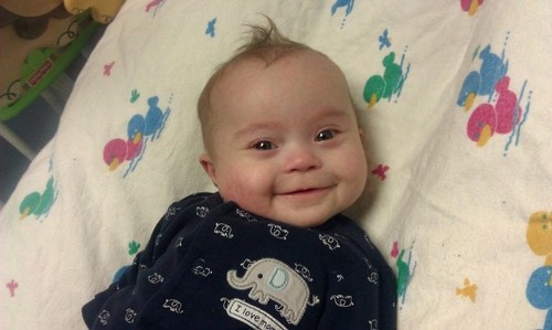 Il torcicollo nei neonati. Bambino che sorride sul lettino.