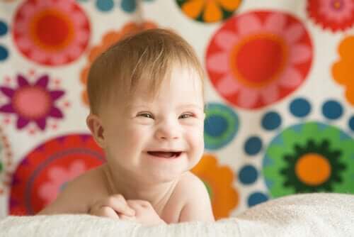 Bambino sorridente con sindrome di Down