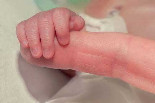 L'importanza dell'affetto per un neonato prematuro