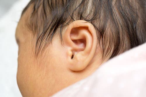 Sordità infantile: l'importanza di una diagnosi precoce