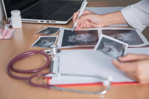 Medico referta delle ecografie: fecondazione eteropaternale