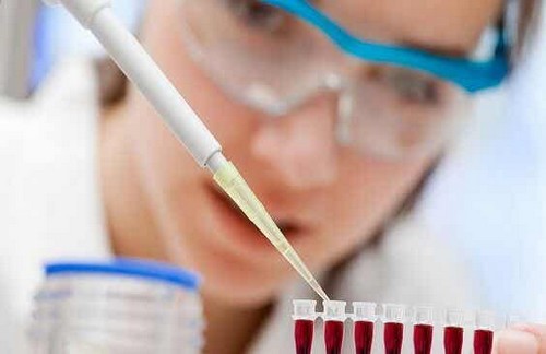 Scienziata esegue un test di laboratorio.