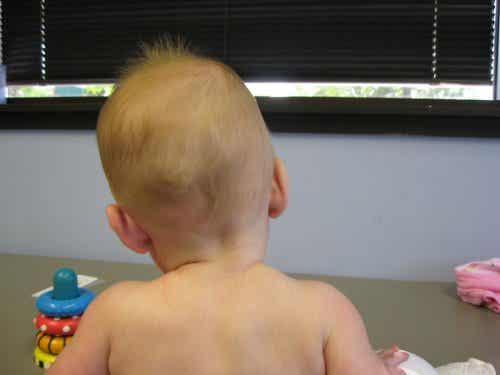 Bambini con torcicollo.