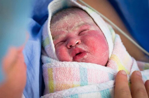 Crosta lattea sul viso del neonato.