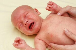 Petecchie nei bambini: cause, sintomi e trattamento