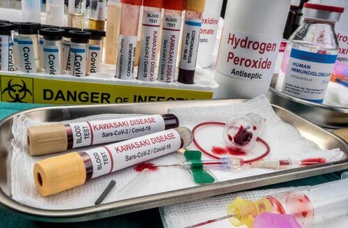 Analisi del sangue.