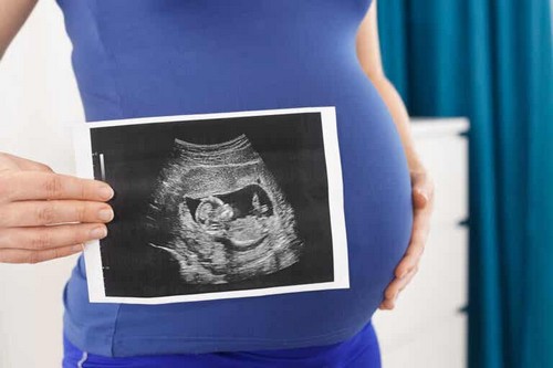 I diversi tipi di ecografia durante la gravidanza: quali sono?