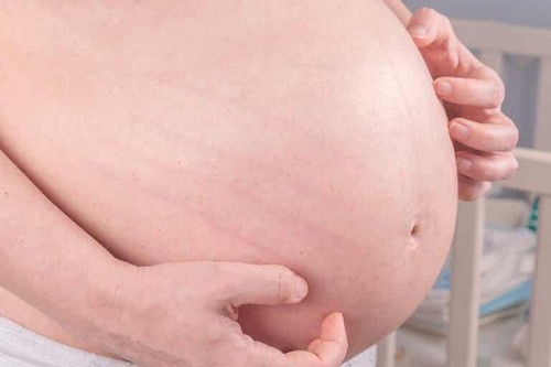 Prurito in gravidanza? Ecco 10 rimedi per attenuarlo