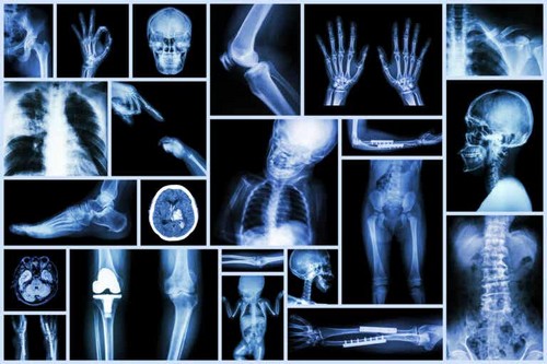 Radiografie sui bambini: ecco cosa dovreste sapere
