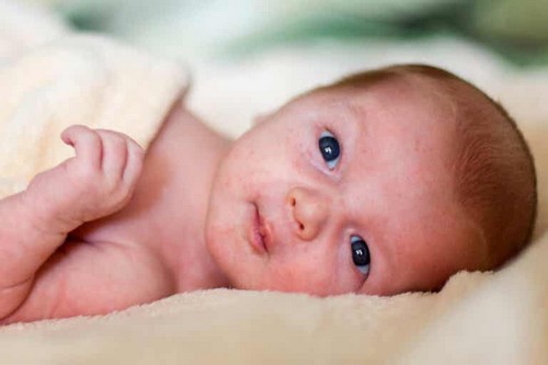 Eruzioni cutanee del bambino: cosa dovreste sapere