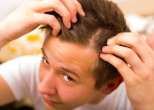 Come prevenire l'alopecia giovanile