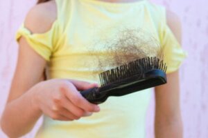 La caduta dei capelli in adolescenza: cause, sintomi e trattamento