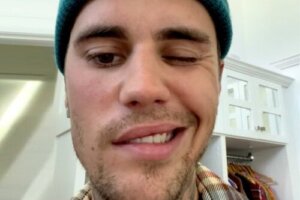Sindrome di Ramsay Hunt, la condizione di cui soffre Justin Bieber