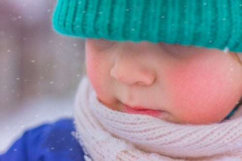 Pelle atopica del bambino: come prendersene cura quando fa freddo