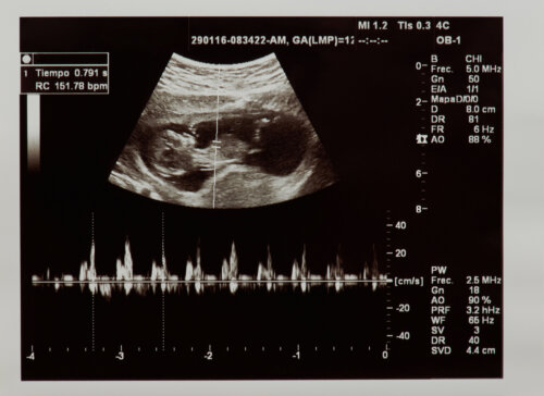 Questo è il battito cardiaco di un feto nel grembo materno