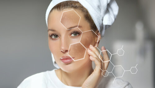 Melasma: come trattarlo in gravidanza e come prevenirlo