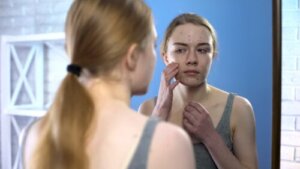 Acne: come influisce sull'autostima?