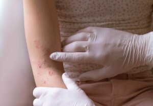 I problemi cutanei più comuni nel primo anno del bambino