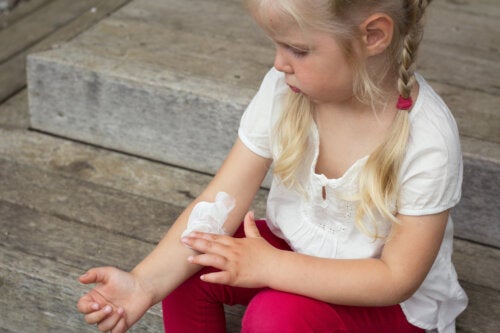 Dermatite infantile: consigli per controllarla
