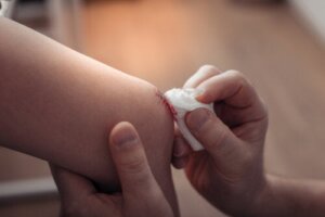 Ascesso nei bambini: sintomi, cause e trattamenti
