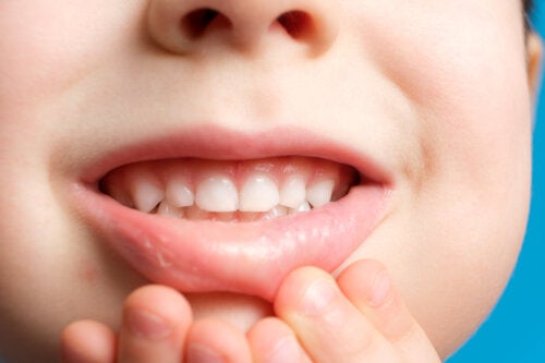 Lo smalto può ricrescere sui denti dei bambini?