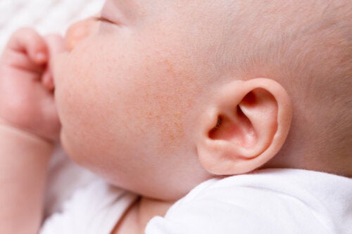 Brufoli sul viso del bambino: a cosa sono dovuti e cosa fare?