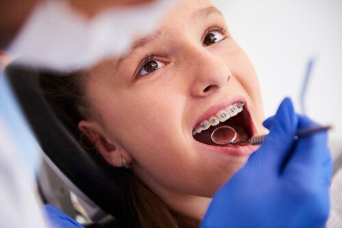 Fasi del trattamento ortodontico nei bambini