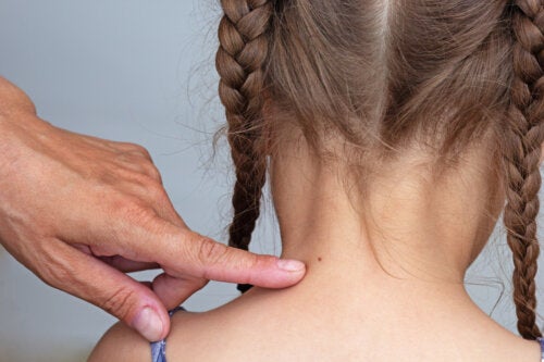 Nei con peli nei bambini: cosa bisogna sapere?